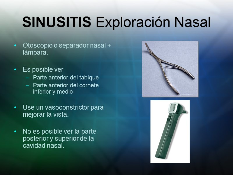 SINUSITIS Exploración Nasal Otoscopio o separador nasal + lámpara.  Es posible ver Parte